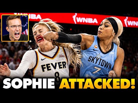MAGA Barbie Sophie Cunningham ATTACKED, Left BLOODY by WNBA Hoodrat Assault: ‘White Privilege!’